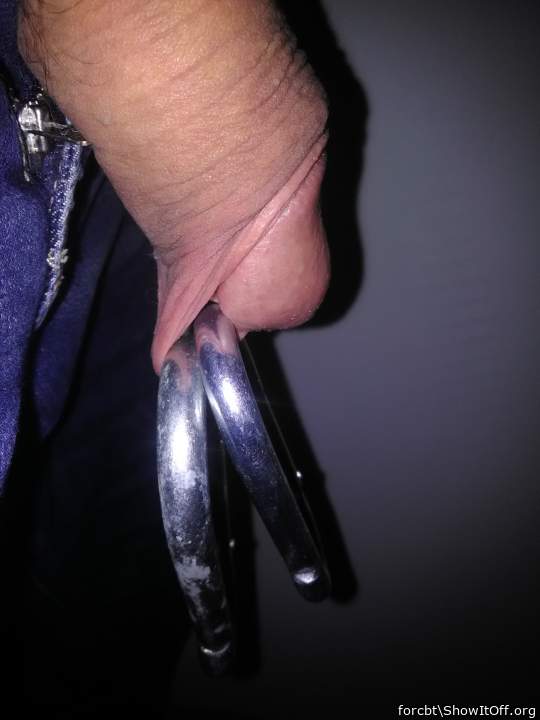 Photo of a middle leg from forcbt