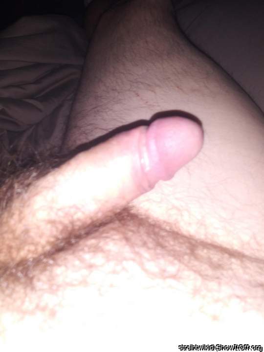 Photo of a short leg from Wikid1