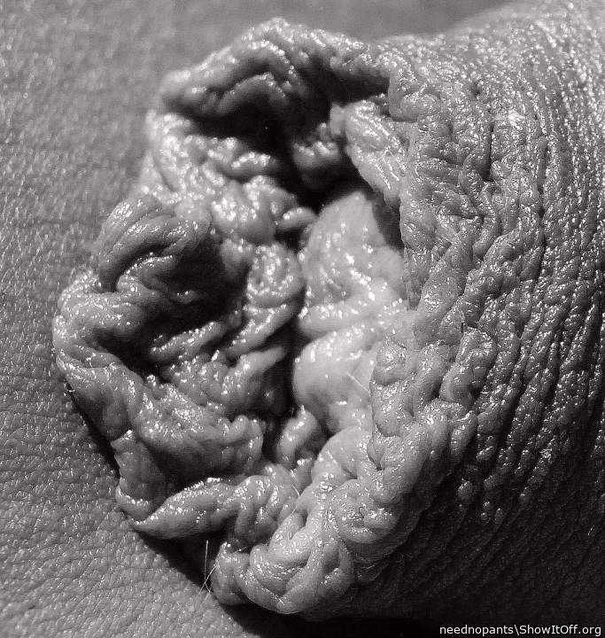 What a foreskin 