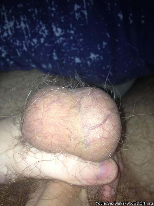 Hairy Balls