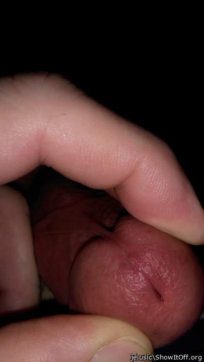 Photo of a prick from jelusic