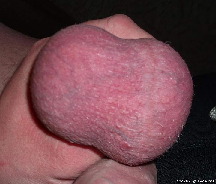 my balls