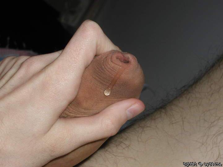 Phimosis