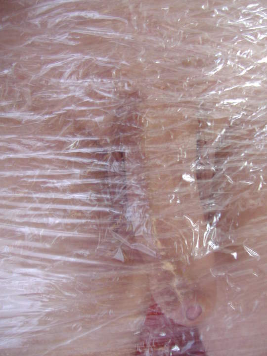 Photo of a one-eyed monster from stecher