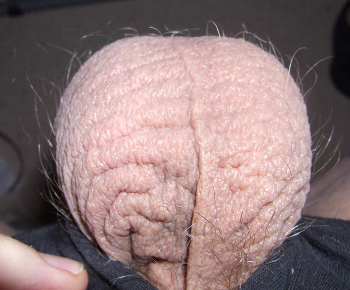 Braiiiiins...