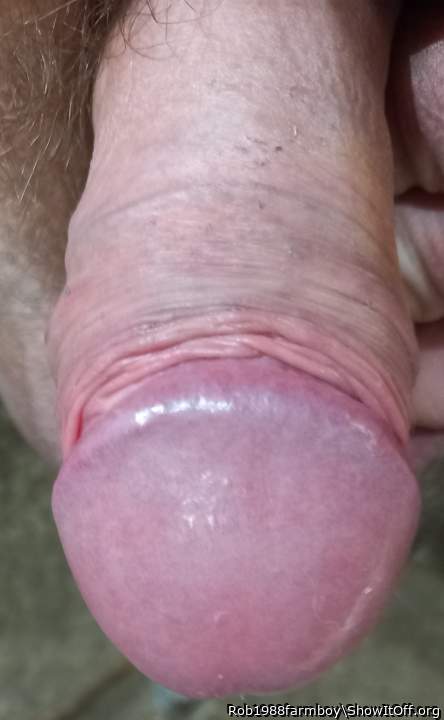 Skin back close up