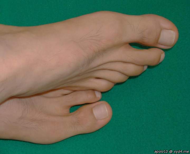 Dude, you have the most beautiful feet that I have ever seen
