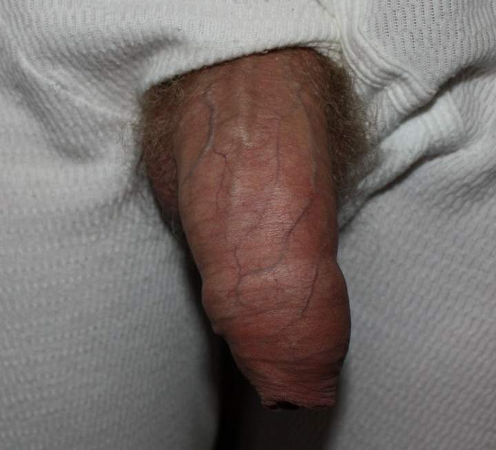 Photo of a middle leg from Sharkie