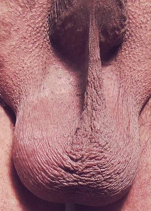 Testicles Photo from greatct