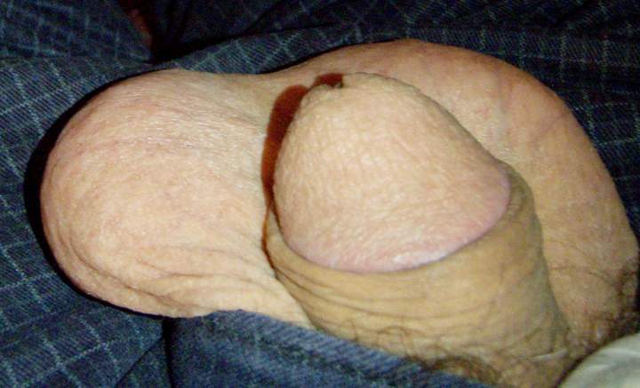Testicles Photo from lilsoftee