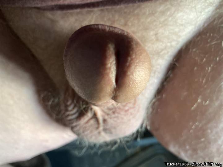 Photo of a penile from Trucker1969-