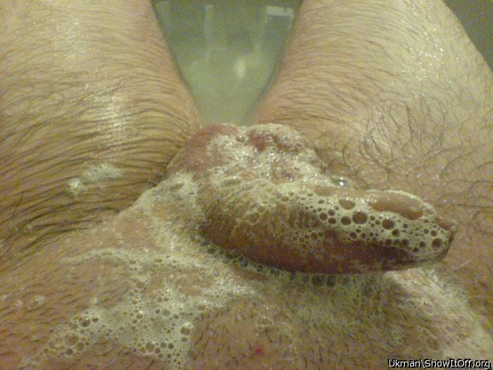 Photo of a penile from Ukman