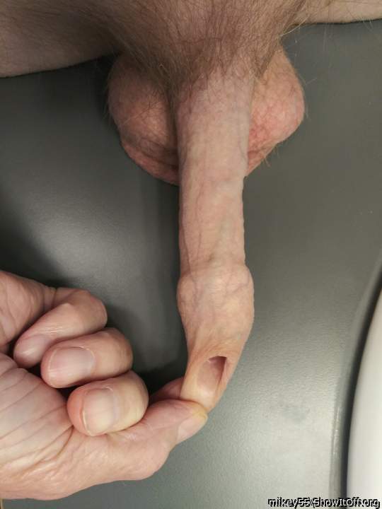 Foreskin