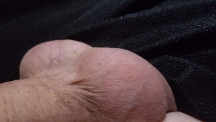 Testicles Photo from box72