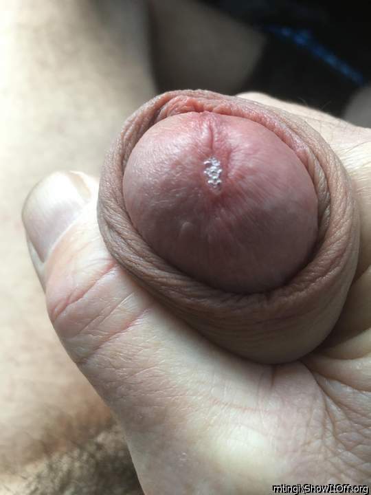 I would love to pull your circumcised foreskin up over your 