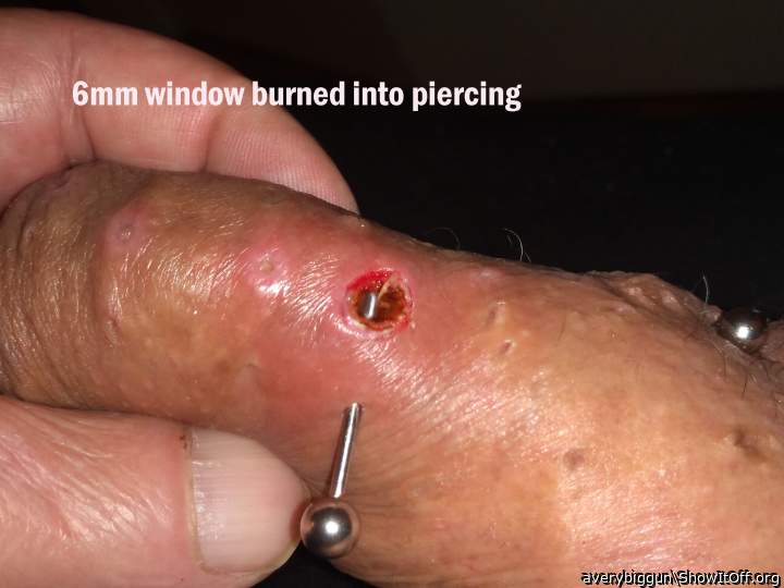 Windowed Piercing