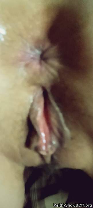 Photo of a penile from Keith