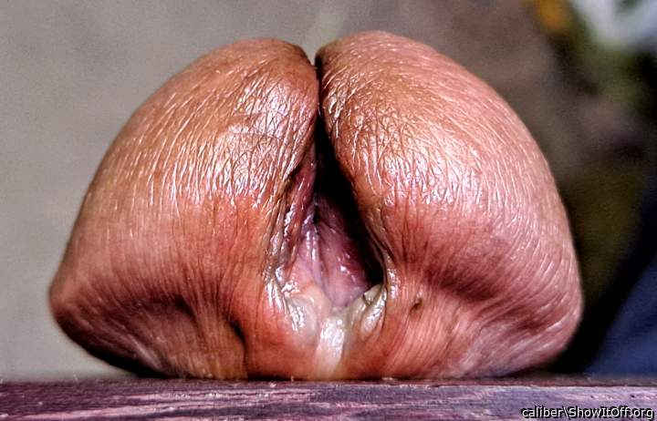 skin coloration