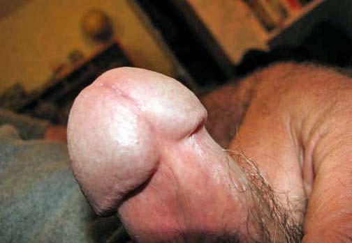 Photo of a bald-headed mouse from turkeyneck