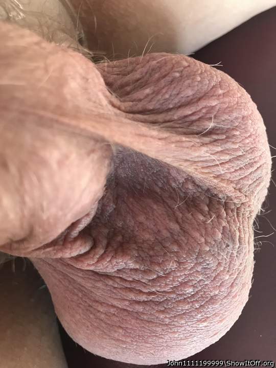 Testicles Photo from John1111199999
