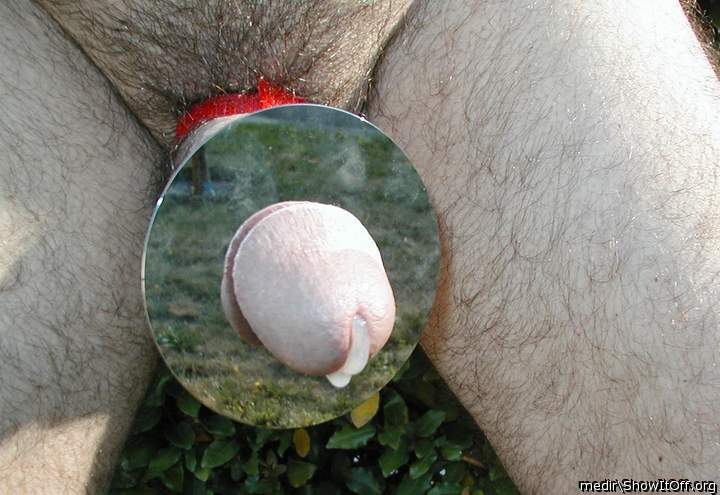 Photo of a short leg from medir