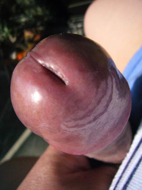 Nikukobu (&#32905;&#30244;)
