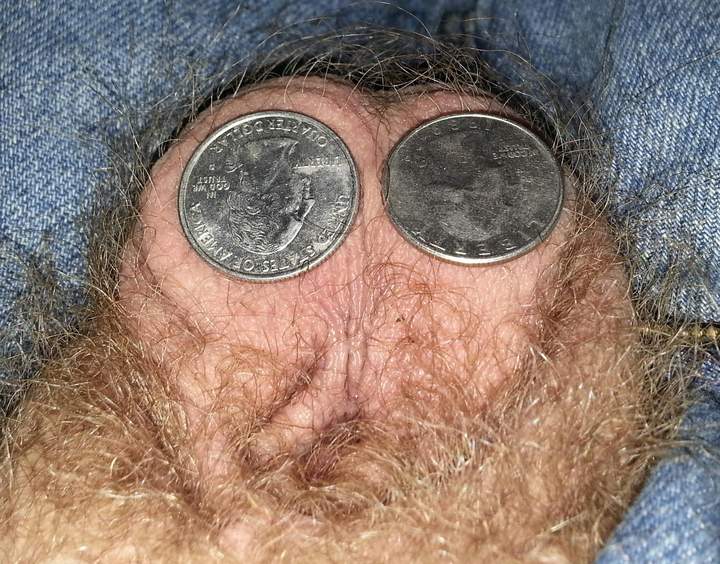 Pic