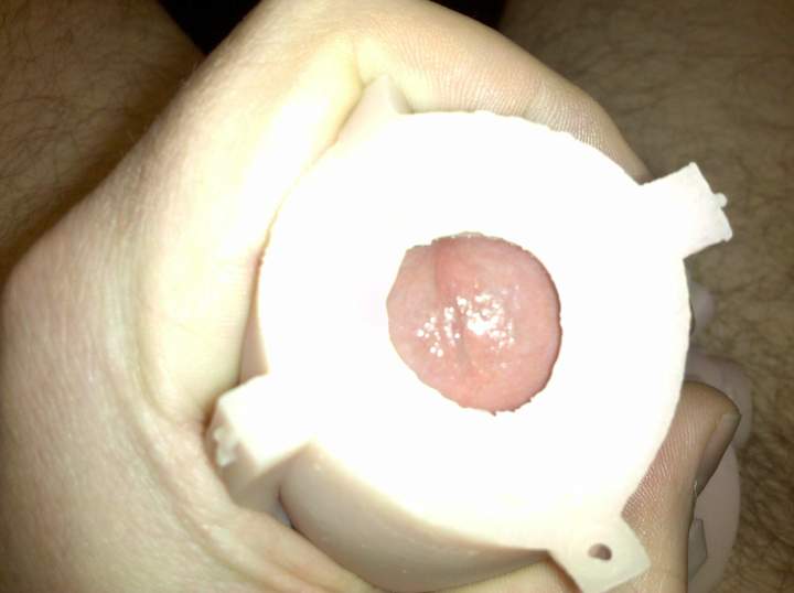 Photo of a bald-headed mouse from skinb