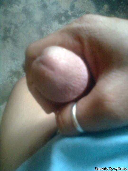 Photo of a phallus from jhonzkie
