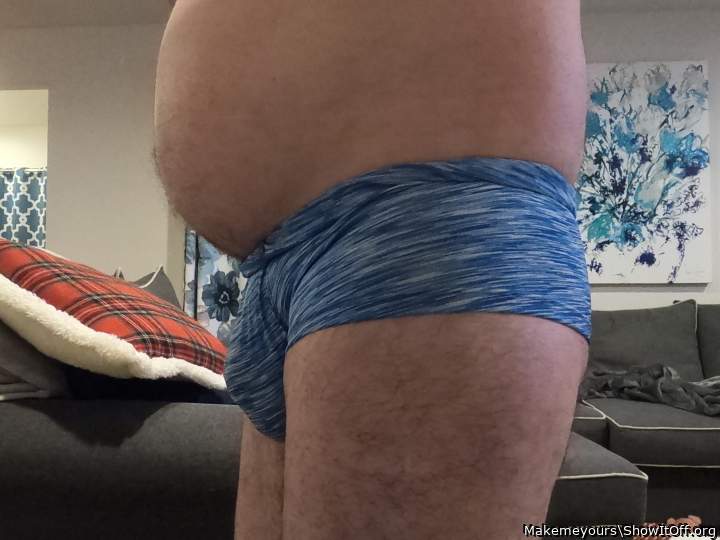 Photo of a short leg from Makemeyours