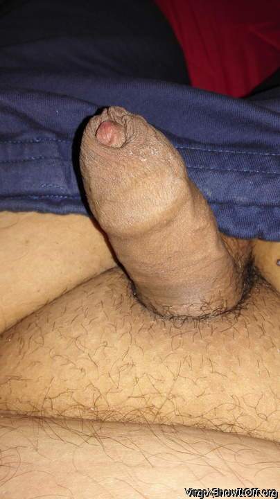 Foreskin flaccid