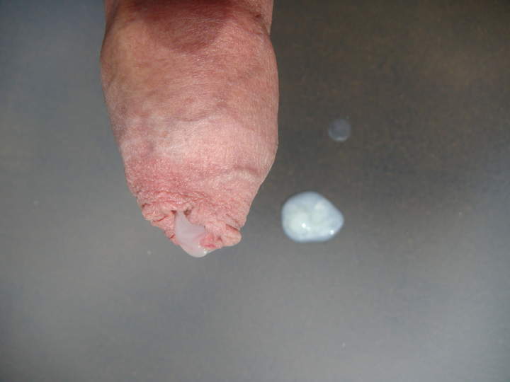 Photo of a dick from sivad666