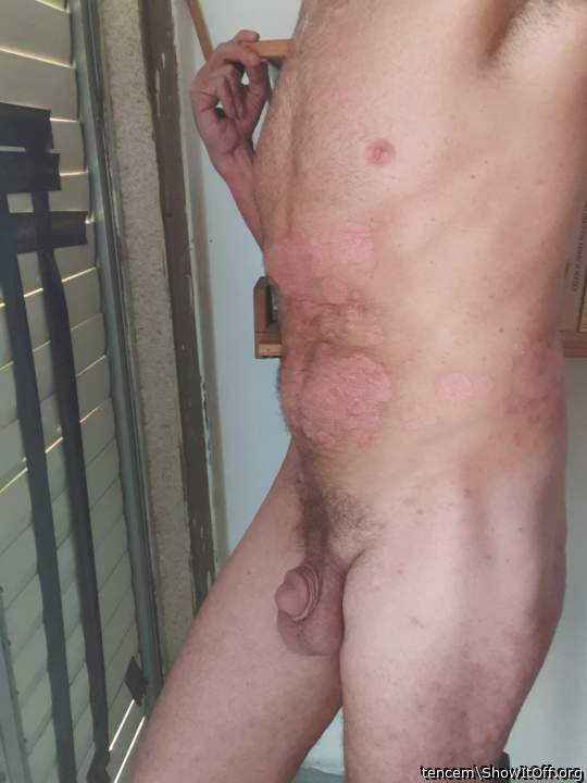 Photo of a prick from tencem