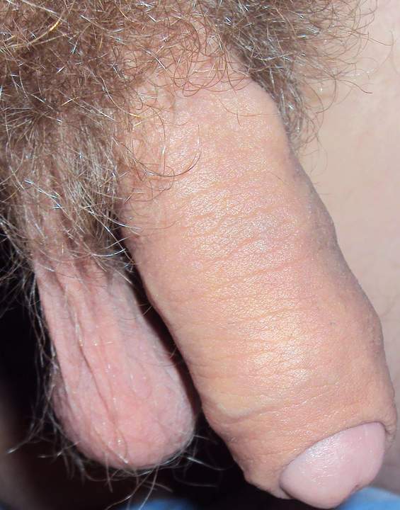 Penis