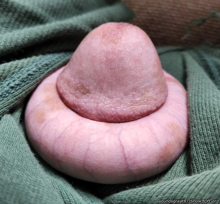 big ring, wrinkled glans