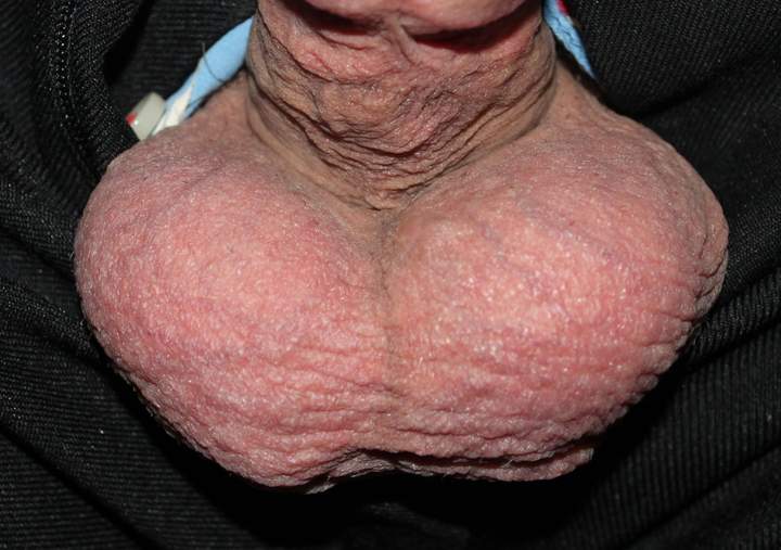 Testicles Photo from lilsoftee