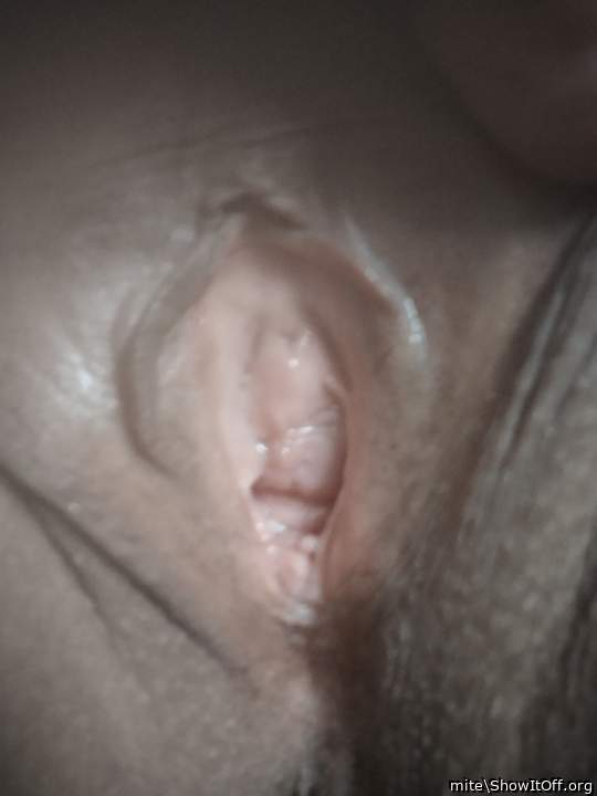 Photo of a phallus from mite
