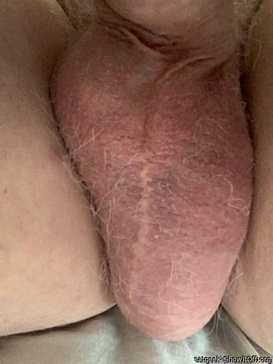 Testicles Photo from satgeek