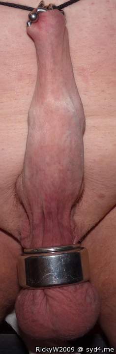 Foreskin at maximum stretch