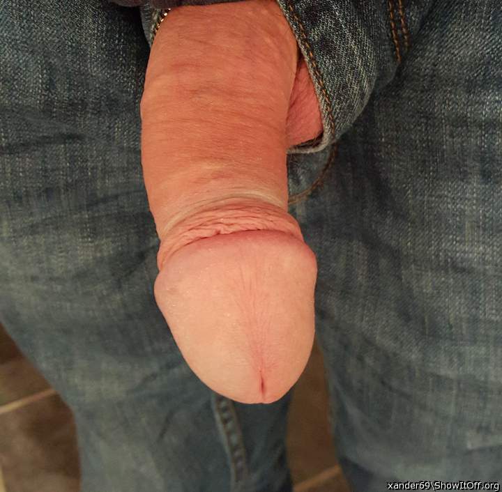 You should have the foreskin circumcised. I love your head  