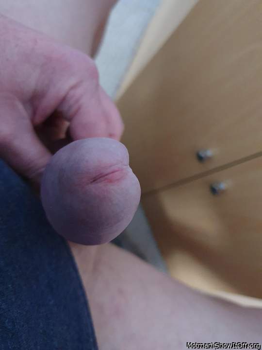 Photo of a short leg from Motman