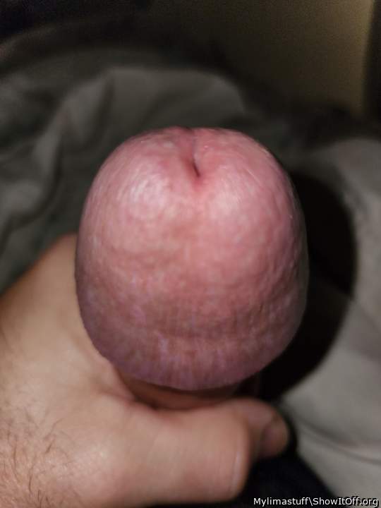 My head!