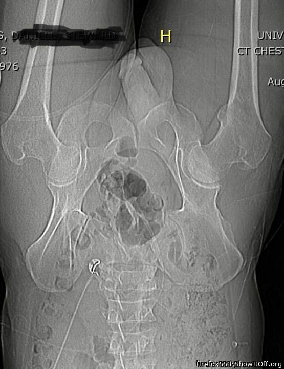 An inside view of my dick