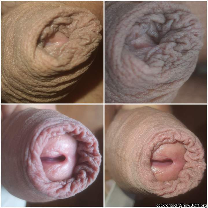 Foreskin collage