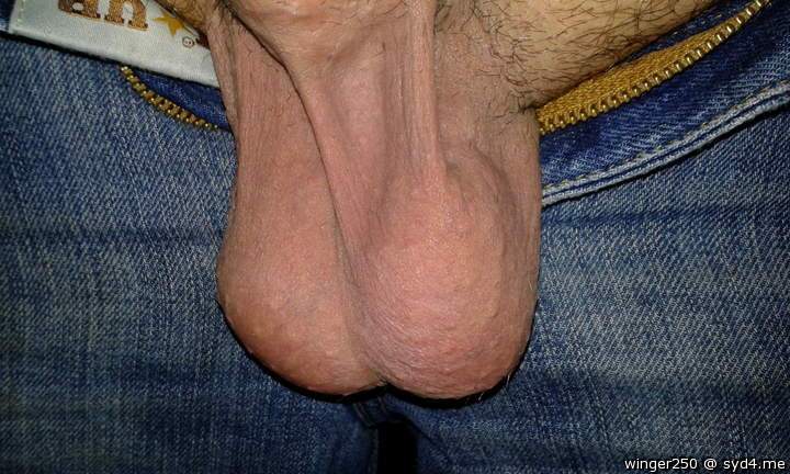 Testicles Photo from winger250