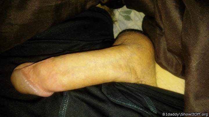 Photo of a middle leg from B1daddy