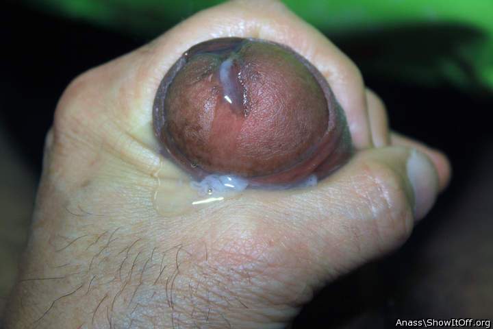 Photo of a short leg from Anass