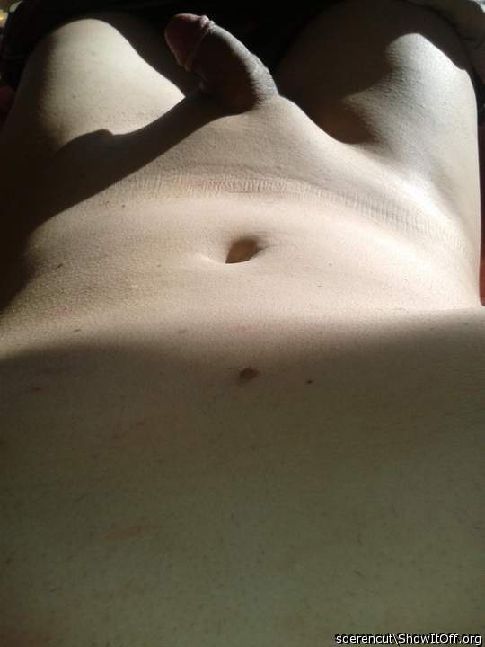 Mein beschnittener penis