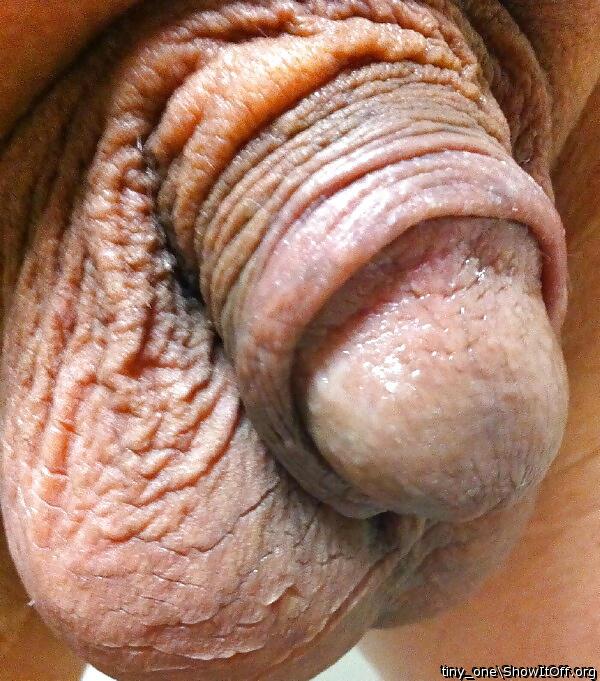 I like your remaining foreskin