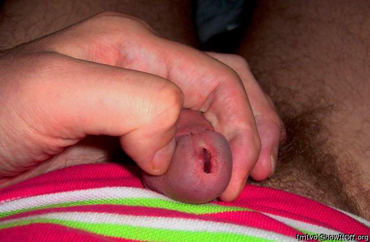 Nude glans (closeup)
